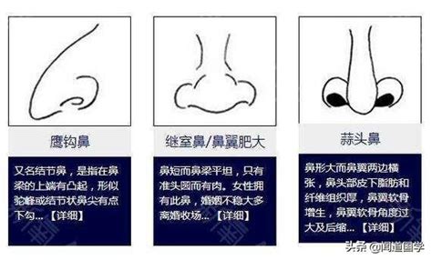 面相 看到鼻孔|鼻相分析10款｜鼻樑有節及橫紋、豬膽鼻、鼻頭下垂代表甚麼？姻 